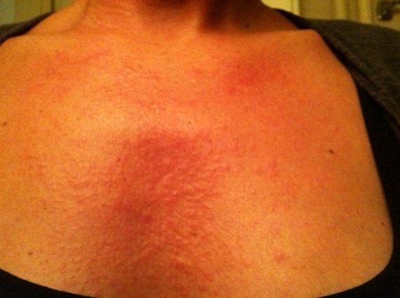 Leslie Carombo blog : LA PEAU