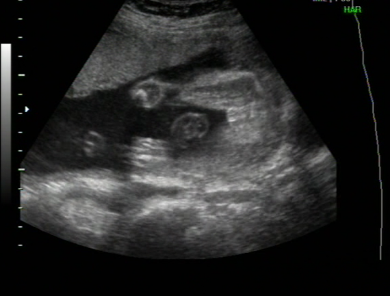 sexe foetus video sexe en francais sexe foetus video sexe en francais
