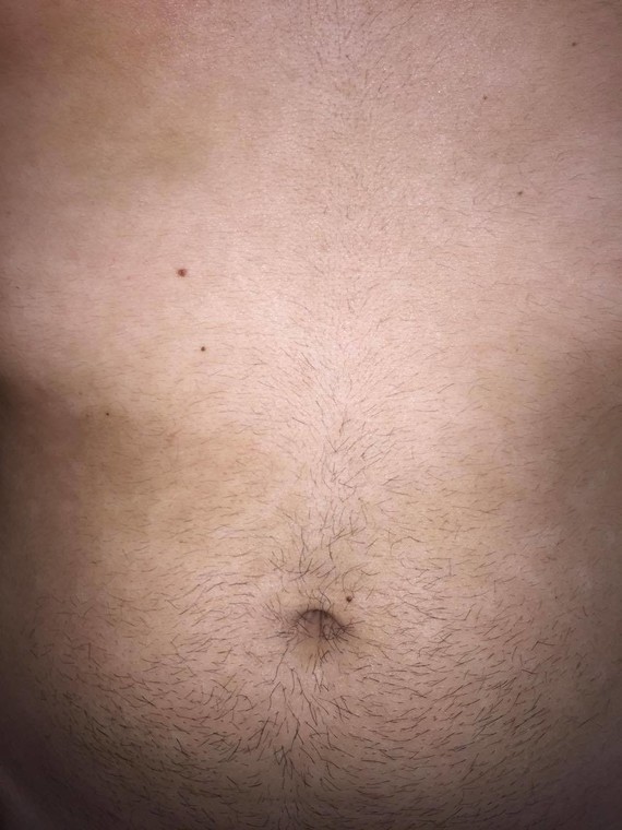 Que faire si de rien naide pas du psoriasis