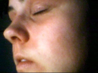 cacher l\u002639;\u00e9cz\u00e9ma sur le visage Page : 2 Allergies et ecz\u00e9ma FORUM Sant\u00e9 cacher l\u002639;\u00e9cz\u00e9ma sur le visage Page : 2 Allergies et ecz\u00e9ma FORUM Sant\u00e9