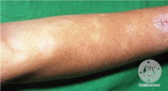 Peau blanche Beauté FORUM Ados Beaute Mode