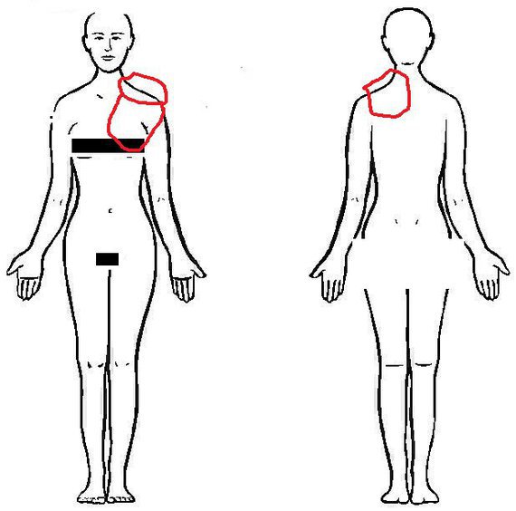 La gymnastique médicale à osteokhondroze spb