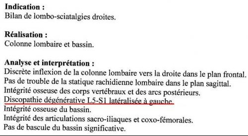 Osteokhondroz du service cervical et les maux de tête