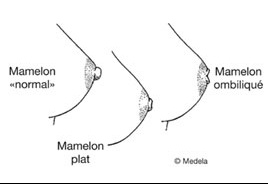 Le col cervical à osteokhondroze le vertige