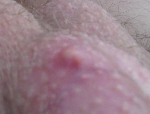 Les moyens des boutons sur la personne dans la pharmacie les rappels