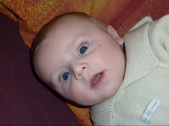 pourquoi bebe a des cernes