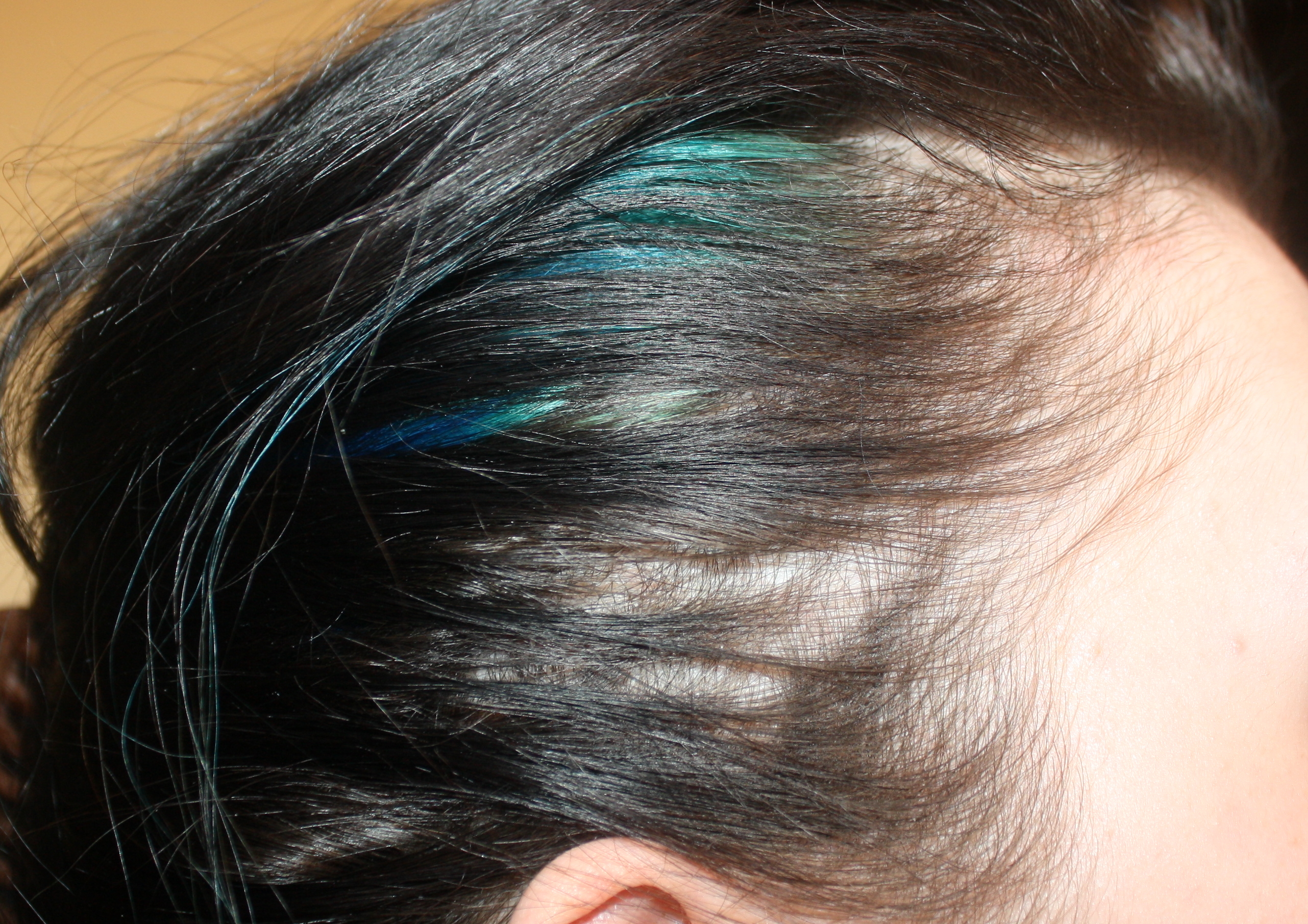 Tempe droite - Cheveux Mars 2013 / Minoxidil 2% Tempe droite - Cheveux Mars 2013 / Minoxidil 2%