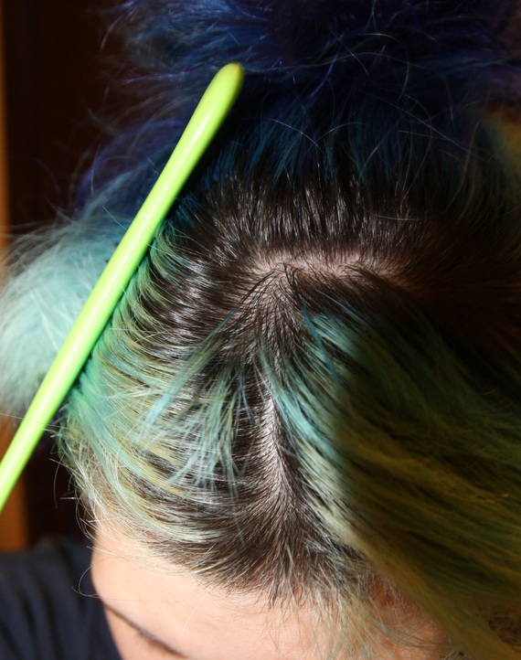 Journal de bord : Femme / Minoxidil 2% + Photos - Page : 3 Journal de bord : Femme / Minoxidil 2% + Photos - Page : 3