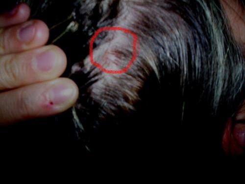 Les propriétés médicales de la moustache dor au psoriasis