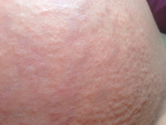 La crème de beauté pour la peau problématique dans la pharmacie les rappels