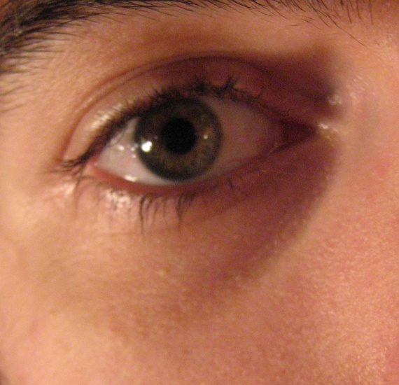 La crème sous les yeux enlever les sacs sous les yeux