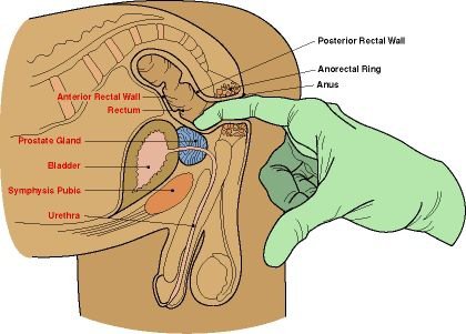 Anal Like 105