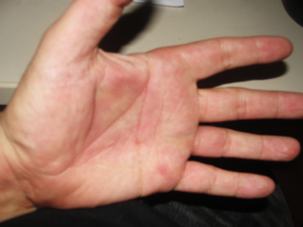 Le blanchiment la personne par le citron les rappels