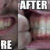 Brossage des dents : l'effet avec du curcuma !