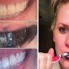 Comment blanchir vos dents naturellement