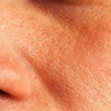 5 solutions naturelles pour réduire les pores dilatés de la peau