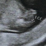 Poids Du Bebe A 30 Sa Grossesse Forum Grossesse Amp Bebe Doctissimo Poids Du Bebe A 30 Sa Grossesse Forum Grossesse Amp Bebe Doctissimo