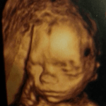 33sa Et Bebe 2kg500 Futures Mamans Forum Grossesse Amp Bebe Doctissimo 33sa Et Bebe 2kg500 Futures Mamans Forum Grossesse Amp Bebe Doctissimo