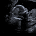 Essai Bebe 1 Pour Soutenons Nous Desir D Enfant Forum Grossesse Amp Bebe Doctissimo Essai Bebe 1 Pour Soutenons Nous Desir D Enfant Forum Grossesse Amp Bebe Doctissimo