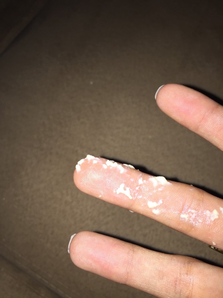 Les Pertes Blanches Annulent Elles Les Ablutions