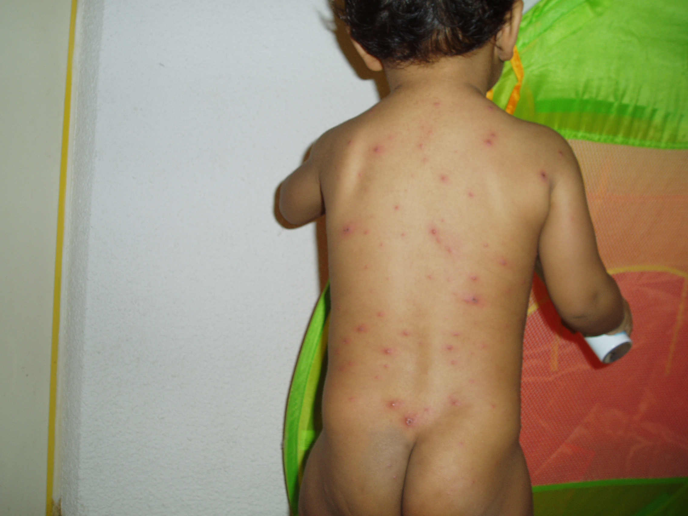 Taches Depuis La Naissance Bebe Grandit Forum Grossesse Amp Bebe Doctissimo Taches Depuis La Naissance Bebe Grandit Forum Grossesse Amp Bebe Doctissimo