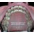 2013-12-08 - Ma dentition haut avec 2 extractions