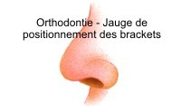 Orthodontic Bracket height gauge with nose