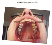 Ryoko - dentition 001 initiale