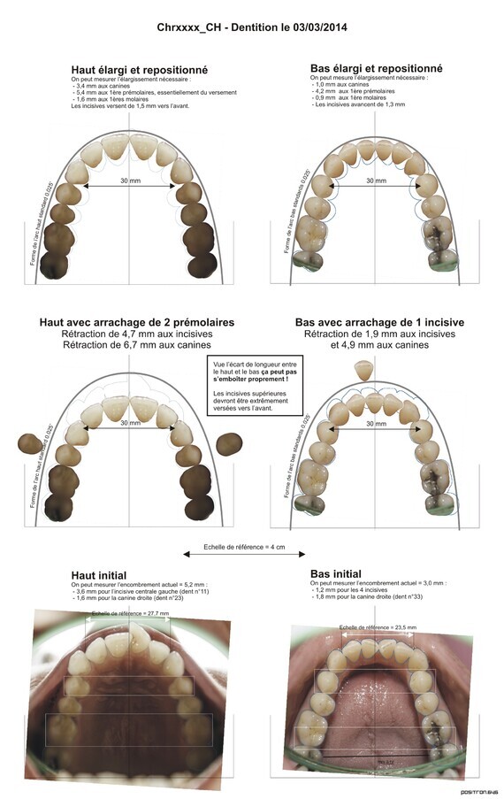 Chrxxxx_CH - Dentition orthodontie 001