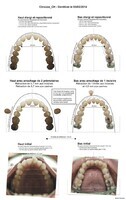 Chrxxxx_CH - Dentition orthodontie 001