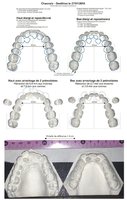 Channels - Dentition orthodontie 001