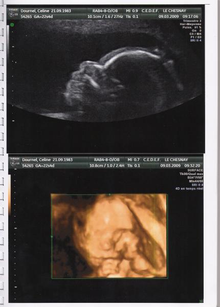 Echo 3d Vous Trouvez Ca Joli Vous Grossesse Forum Grossesse Amp Bebe Doctissimo Echo 3d Vous Trouvez Ca Joli Vous Grossesse Forum Grossesse Amp Bebe Doctissimo