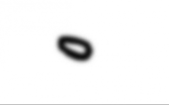 Tache Coloree A Un Oeil Je Vous Montre En Image