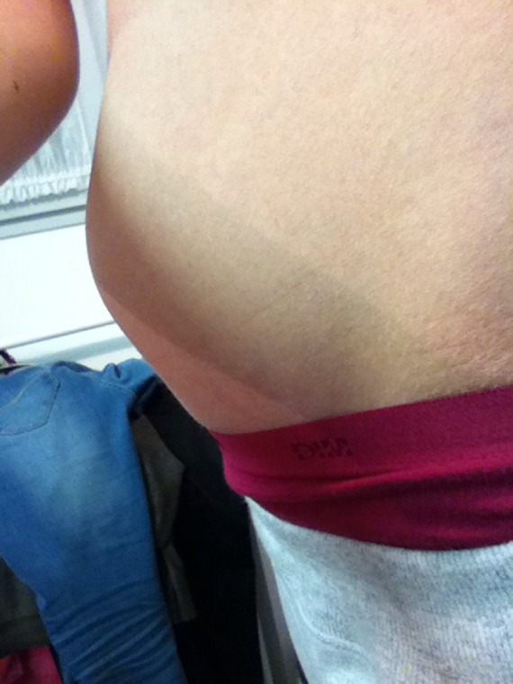 Ventre Gonfle Grossesse Ou Pilule Deni De Grossesse Forum Grossesse Amp Bebe Doctissimo