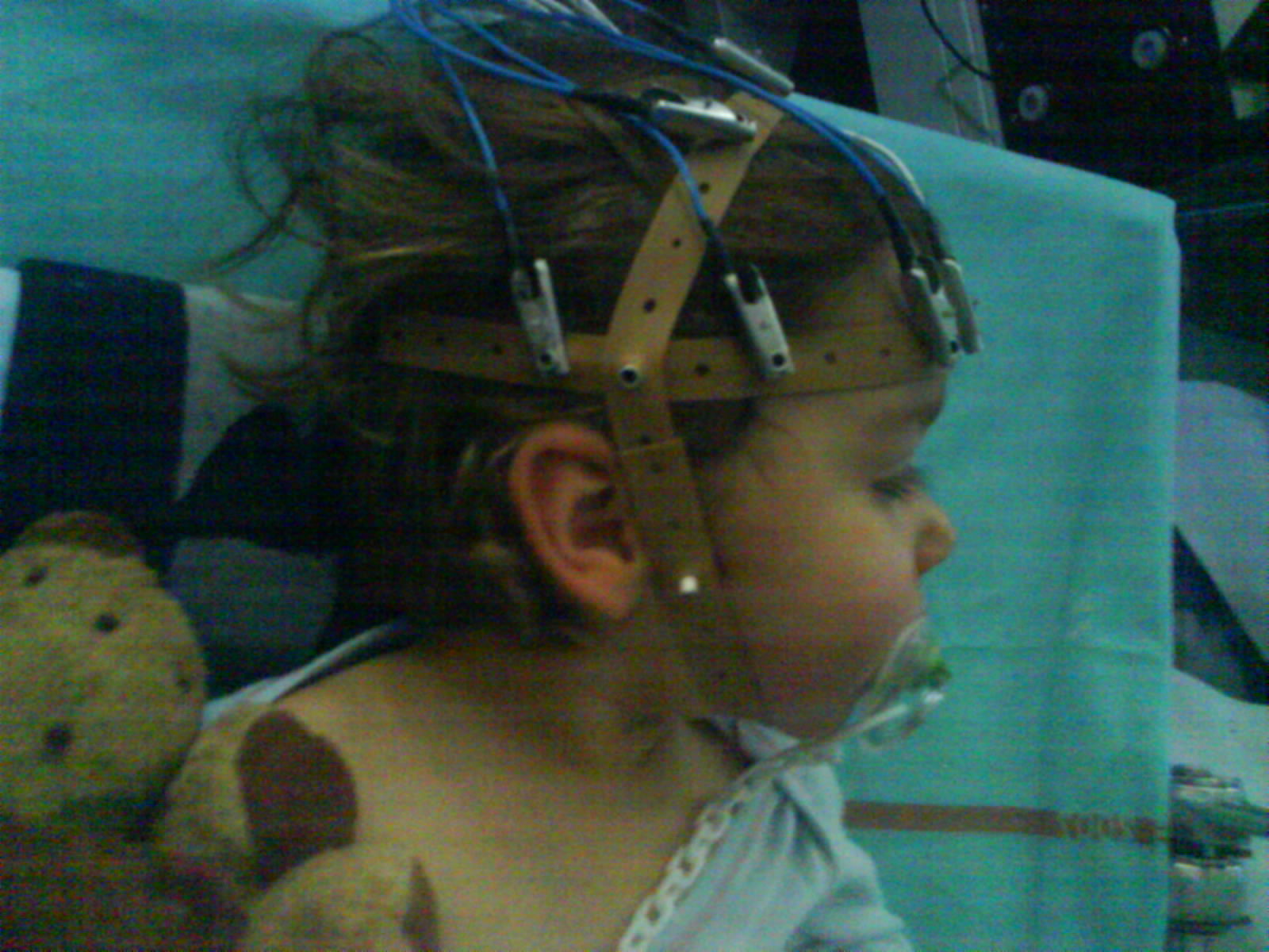 Eeg Sante De L Enfant Forum Sante Doctissimo Eeg Sante De L Enfant Forum Sante Doctissimo