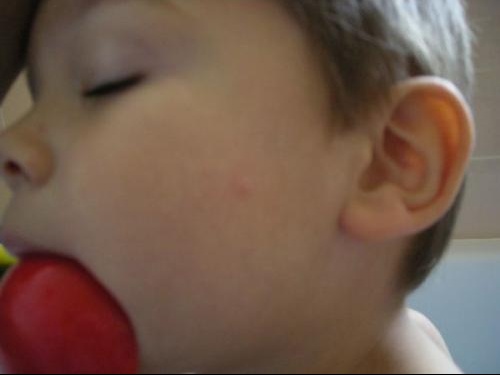 Varicelle Non Chenilles Processionnaires Bebe Grandit Forum Grossesse Amp Bebe Doctissimo Varicelle Non Chenilles Processionnaires Bebe Grandit Forum Grossesse Amp Bebe Doctissimo