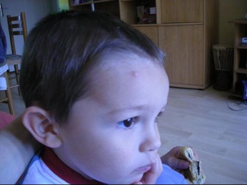 Varicelle Non Chenilles Processionnaires Bebe Grandit Forum Grossesse Amp Bebe Doctissimo Varicelle Non Chenilles Processionnaires Bebe Grandit Forum Grossesse Amp Bebe Doctissimo