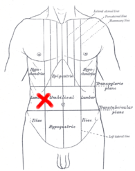 Sang Dans Les Selles Douleur Abdominale Maux De Ventre D Estomac Ulceres Forum Sante Doctissimo