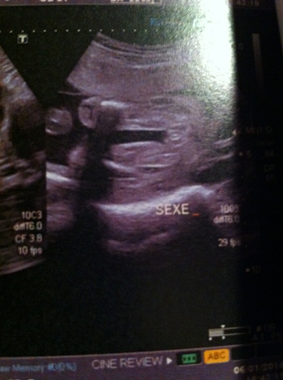 22 Sa Sexe Bebe Nouvelle Photo 22 Sa Sexe Bebe Nouvelle Photo