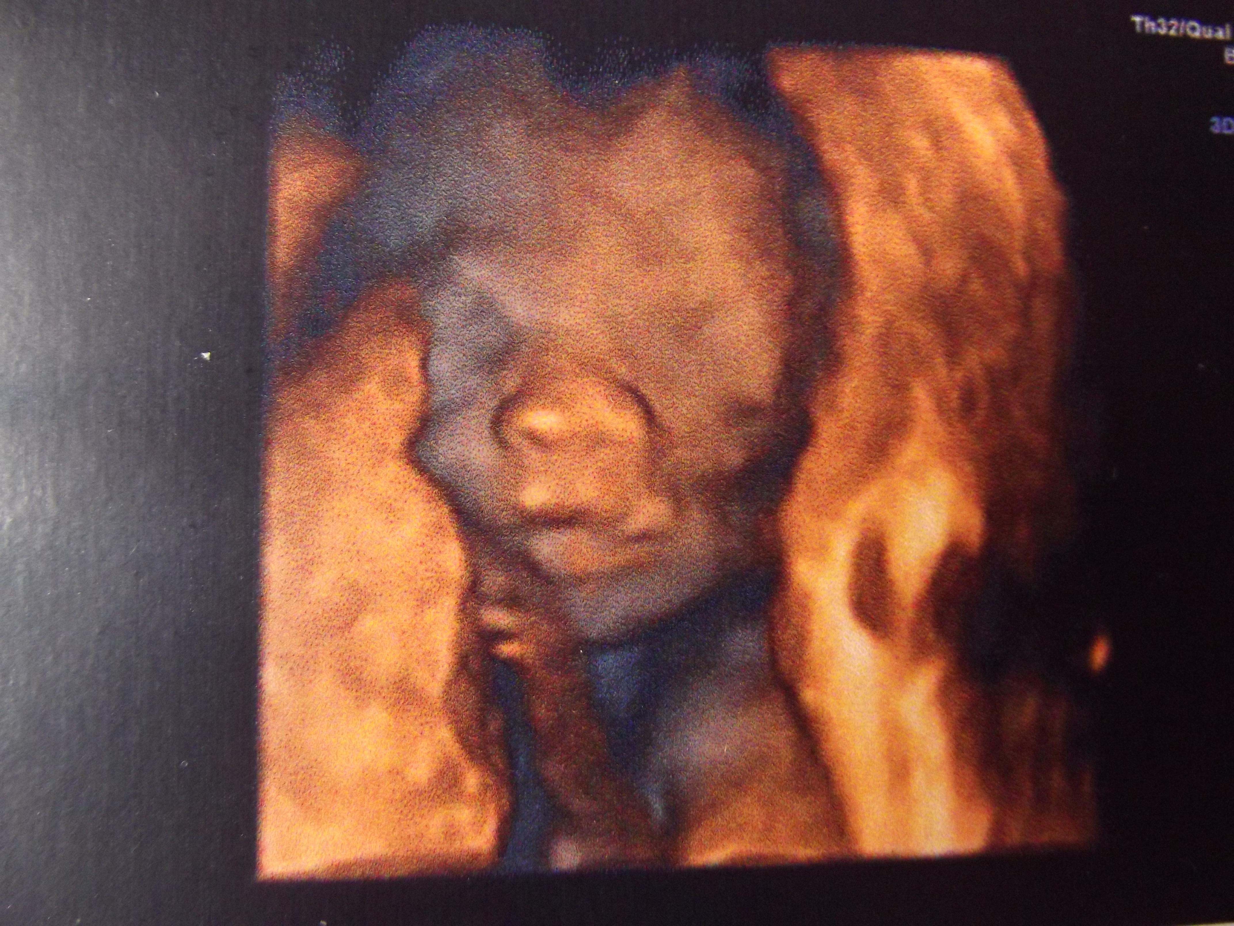 Le Meilleur Moment Pour Echo 3d Echographie Connaitre Le Sexe De Votre Bebe Forum Grossesse Amp Bebe Doctissimo Le Meilleur Moment Pour Echo 3d Echographie Connaitre Le Sexe De Votre Bebe Forum Grossesse Amp Bebe Doctissimo