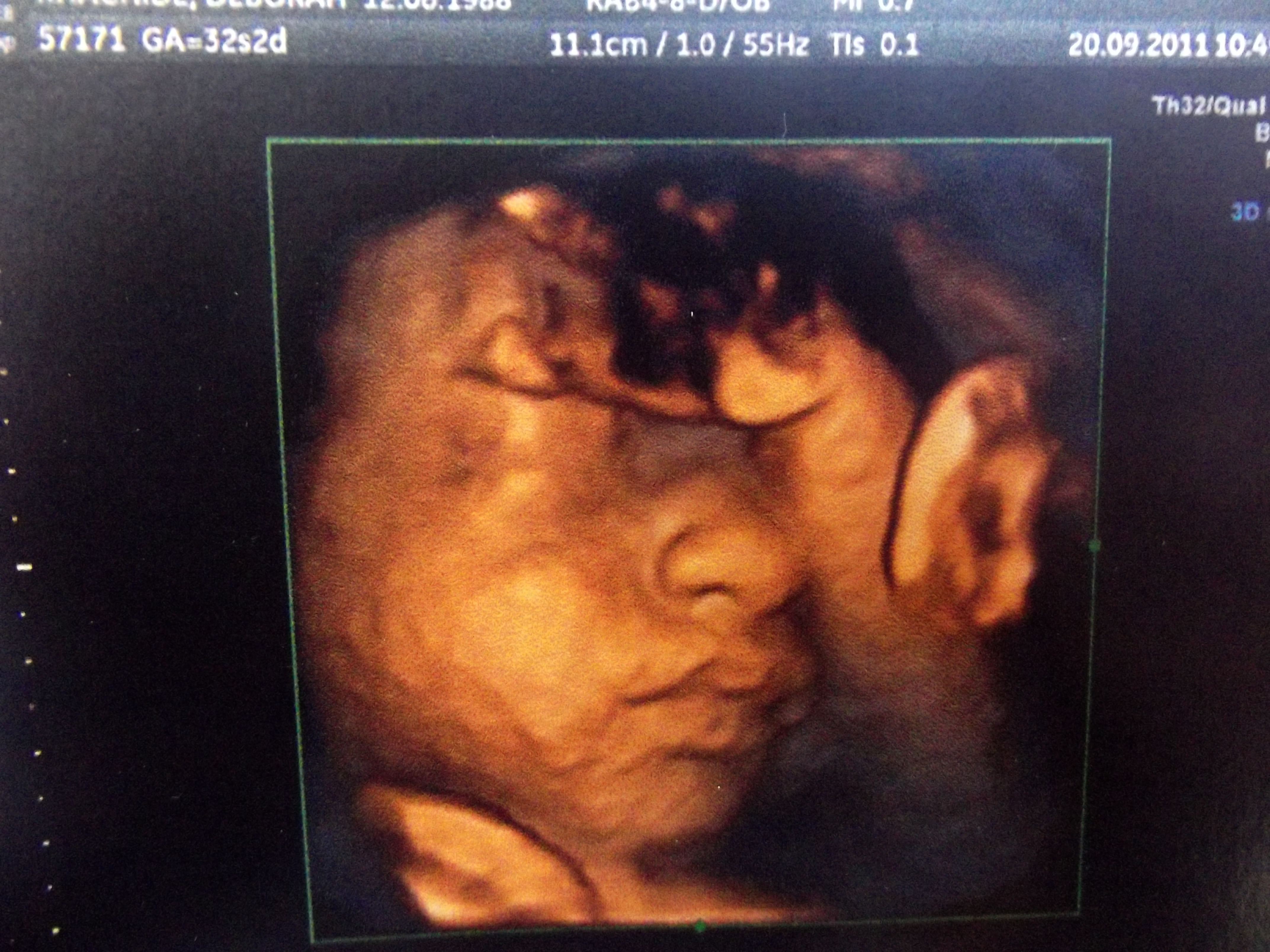 Echo 3d Et Ressemblance Echographie Connaitre Le Sexe De Votre Bebe Forum Grossesse Amp Bebe Doctissimo Echo 3d Et Ressemblance Echographie Connaitre Le Sexe De Votre Bebe Forum Grossesse Amp Bebe Doctissimo