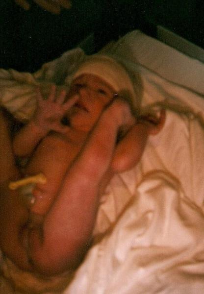 Siege Et Accouchement Vb Accouchement Forum Grossesse Amp Bebe Doctissimo