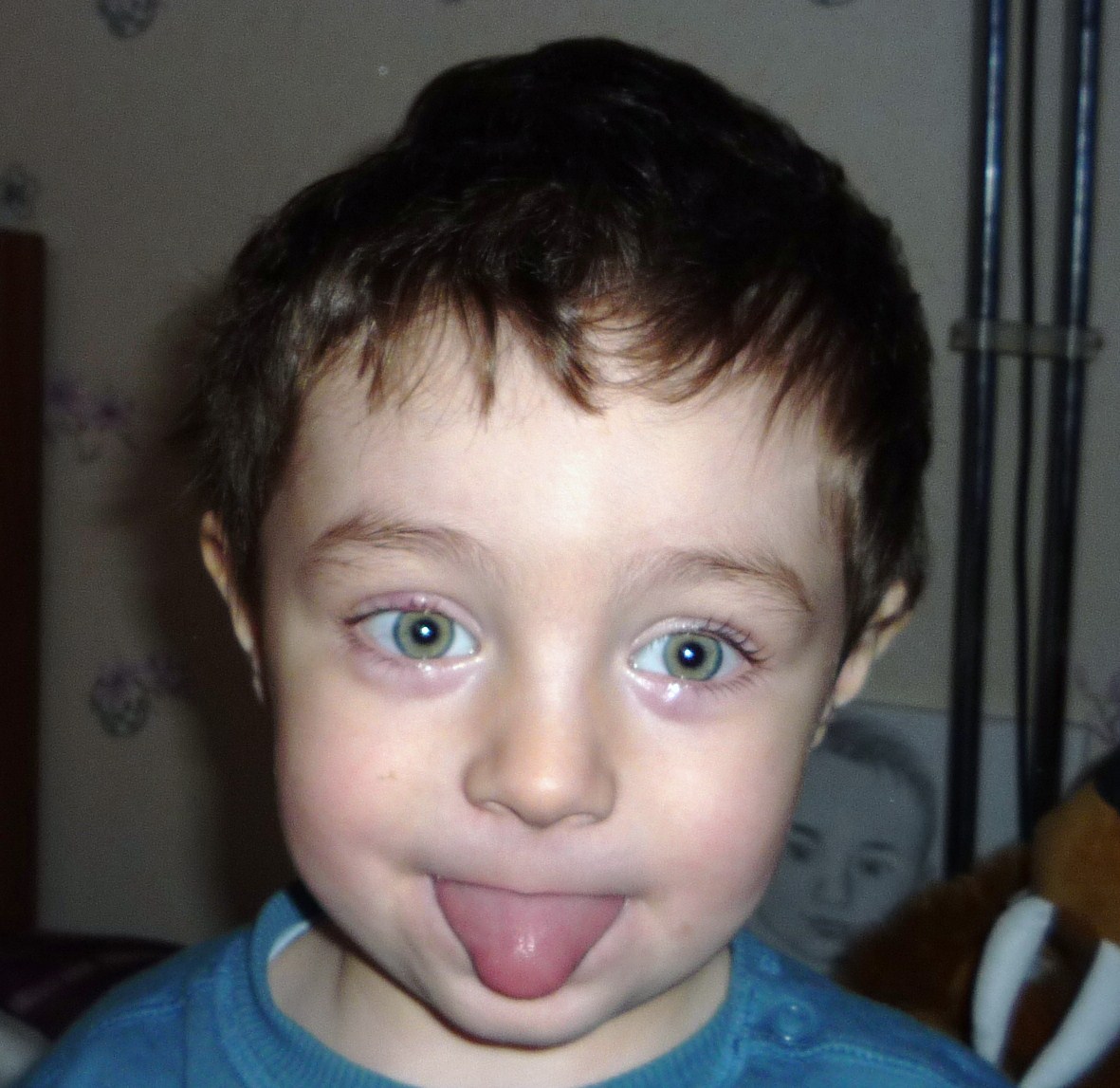 Chalazion Qui Ne Part Pas Help Myopie Cataracte Et Problemes De Vue Forum Sante Doctissimo