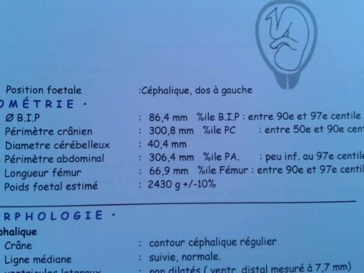 Echo 32sa Gros Bebe Quel Poids A 36 Sa Echo De Controle Echographie Connaitre Le Sexe De Votre Bebe Forum Grossesse Amp Bebe Doctissimo Echo 32sa Gros Bebe Quel Poids A 36 Sa Echo De Controle Echographie Connaitre Le Sexe De Votre Bebe Forum Grossesse Amp Bebe Doctissimo