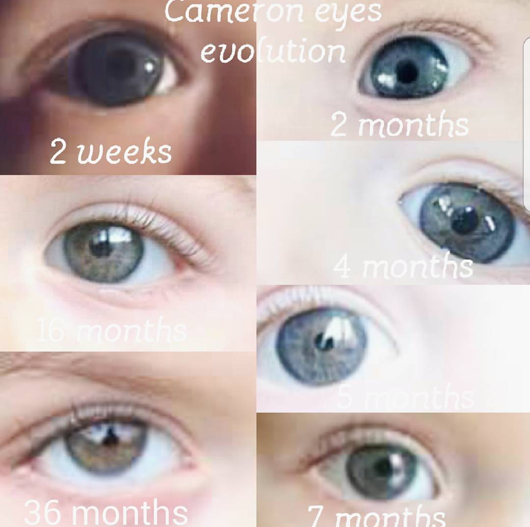 Couleur Yeux Bebe 5 Mois Janvier 18 Bebe Grandit Forum Grossesse Amp Bebe Doctissimo