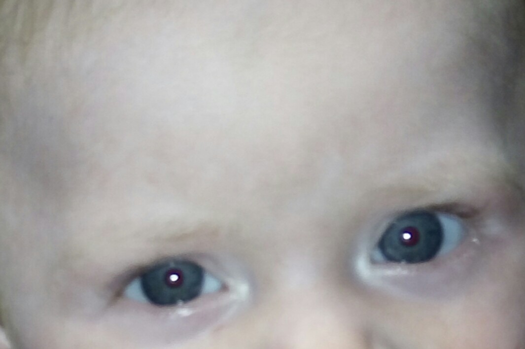 Yeux De Bebe Bebe Grandit Forum Grossesse Amp Bebe Doctissimo Yeux De Bebe Bebe Grandit Forum Grossesse Amp Bebe Doctissimo