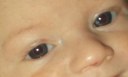 Yeux De Bebe Bebe Grandit Forum Grossesse Amp Bebe Doctissimo