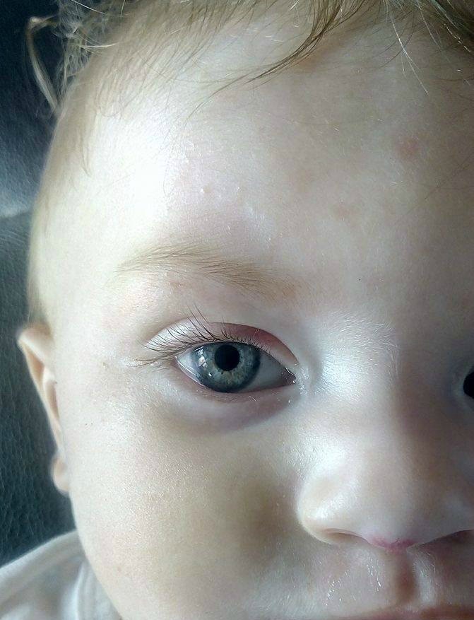 Yeux De Bebe Bebe Grandit Forum Grossesse Amp Bebe Doctissimo