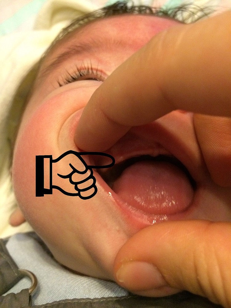 Dents Bebe Grandit Forum Grossesse Amp Bebe Doctissimo Dents Bebe Grandit Forum Grossesse Amp Bebe Doctissimo