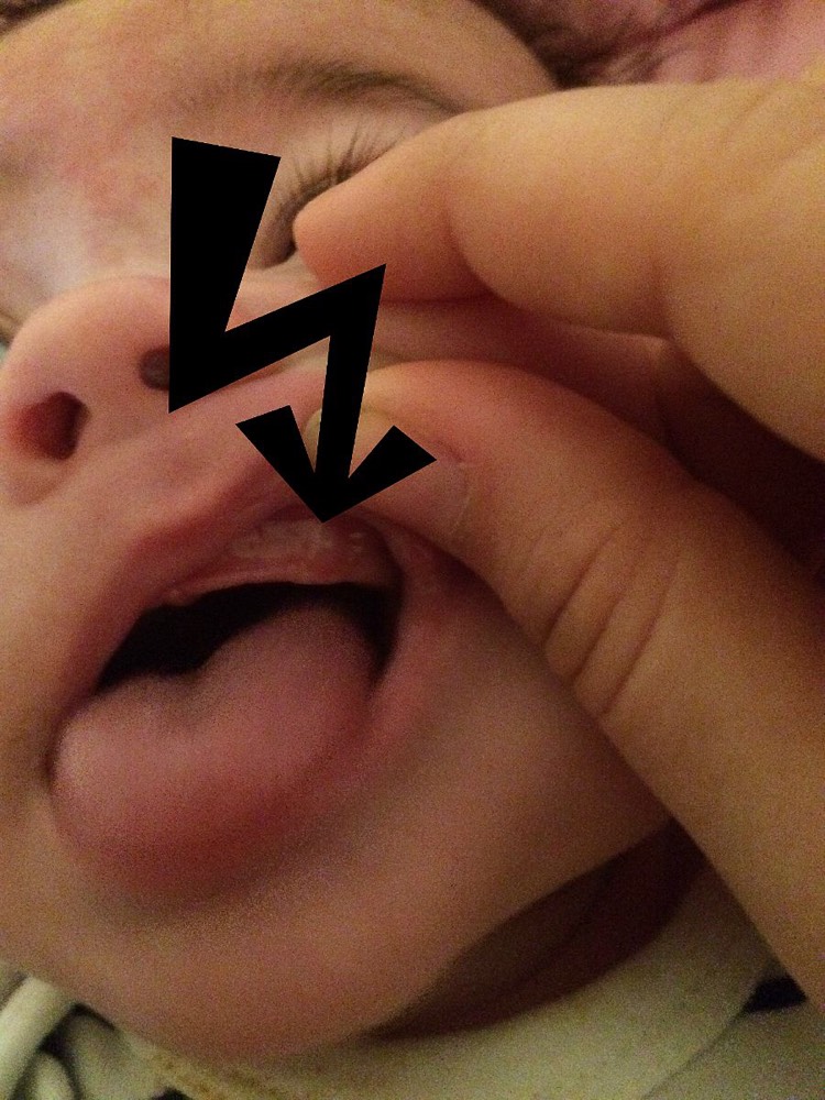 Dents Bebe Grandit Forum Grossesse Amp Bebe Doctissimo Dents Bebe Grandit Forum Grossesse Amp Bebe Doctissimo